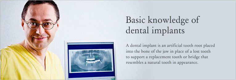 Basic knowledge of dental implants A dental implant is an artificial tooth root placed into the bone of the jaw in place of a lost tooth to support a replacement tooth or bridge that resembles a natural tooth in appearance.