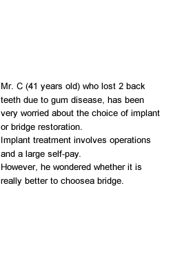 Mr. C (41 years old) who lost 2 back teeth due to gum disease, has been very worried about the choice of implant or bridge restoration.Implant treatment involves operations and a large self-pay. However, he wondered whether it is really better to choose a bridge.